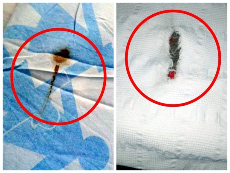 Otro escándalo: prendas de hospital de EsSalud Moquegua sucias, viejas, rotas y con manchas de sangre