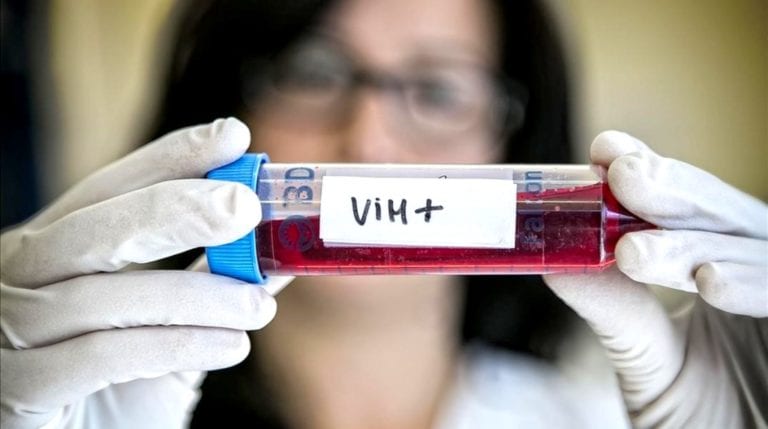 VIH: Un estudio científico abre una puerta para acabar con el virus del sida