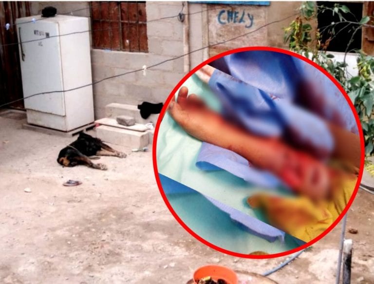 Horror en Ilo: Perro ataca a niña de 4 años y le arranca parte del brazo