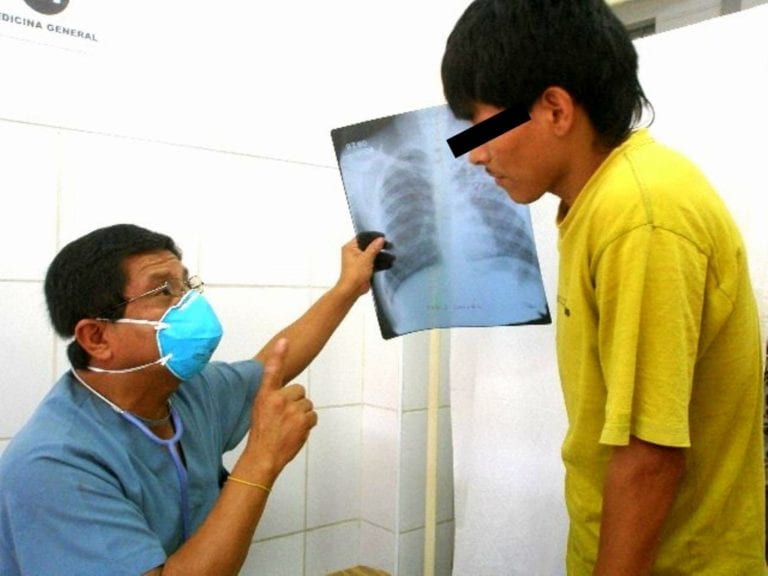 A 191 llega el número de casos con TBC en Moquegua