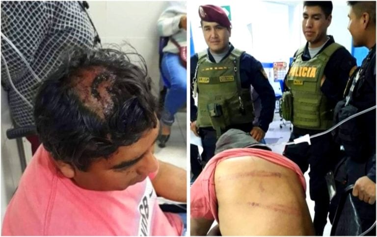 Denuncian a policías que agredieron brutalmente a trabajadores municipales durante paro en Tumilaca 
