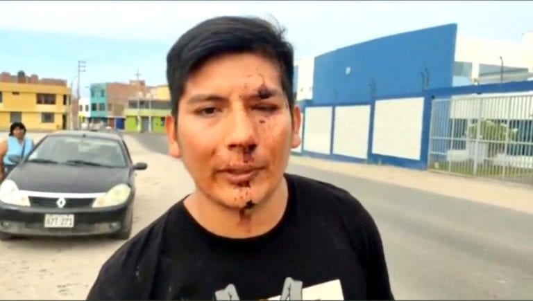 Joven es agredido a botellazos en exteriores de discoteca de playa Montecarlo