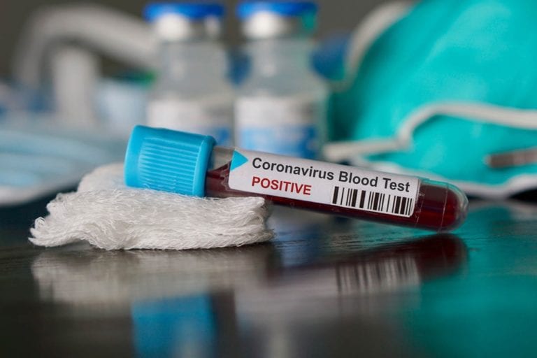 Coronavirus: región Moquegua reporta su primer caso positivo