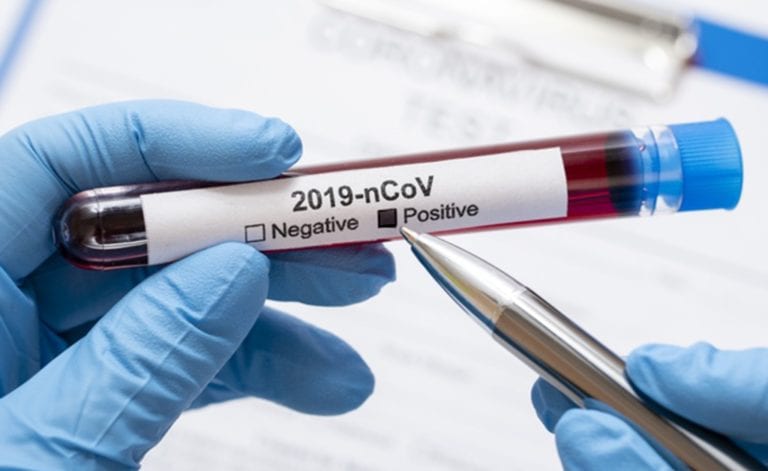 173 casos confirmados con coronavirus en la región Moquegua