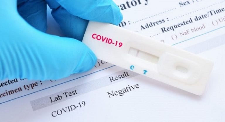 Islay contabiliza 117 casos positivos para Covid-19