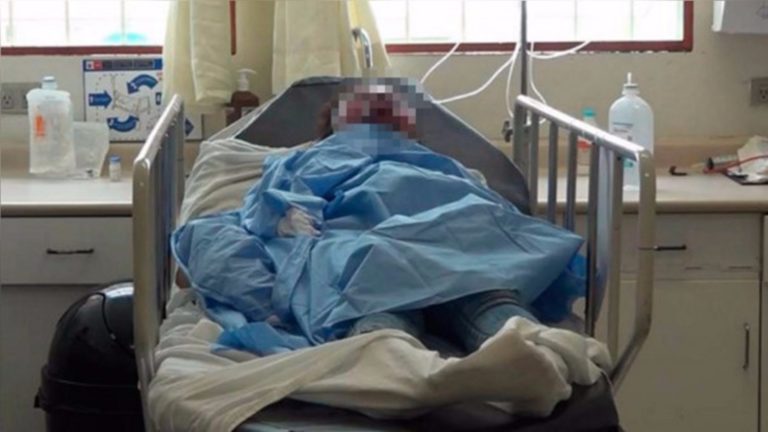 Arequipa: Mujer llega a nosocomio con signos de intoxicación por móvil aparente de suicidio