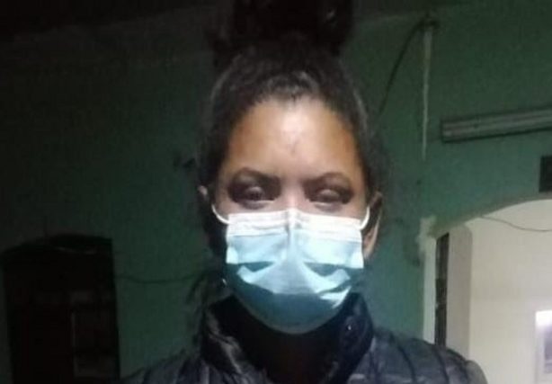 Arequipa: mujer venezolana desfigura el rostro de “amiga”
