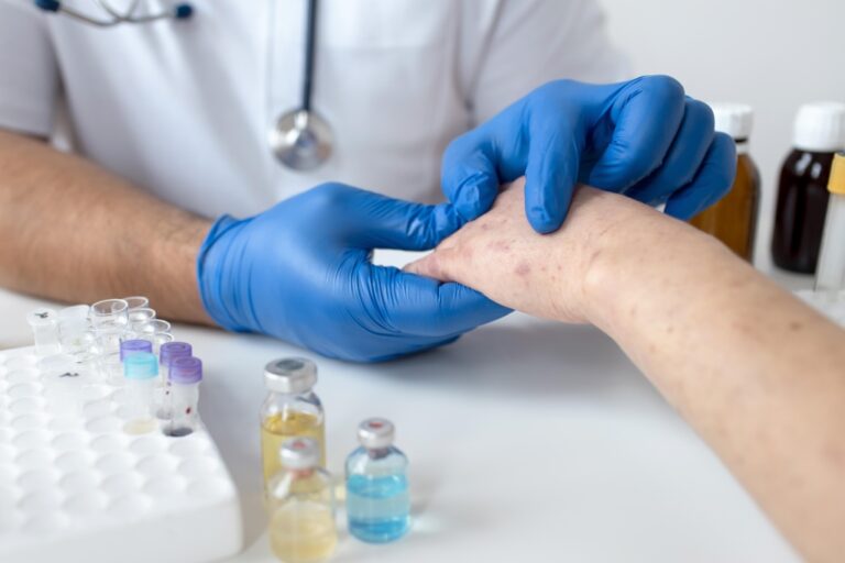 Mpox o viruela del mono: transmisión, síntomas y lo que debes saber