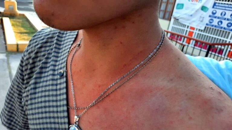 Detenido por robar celular a menor con «cogoteo»