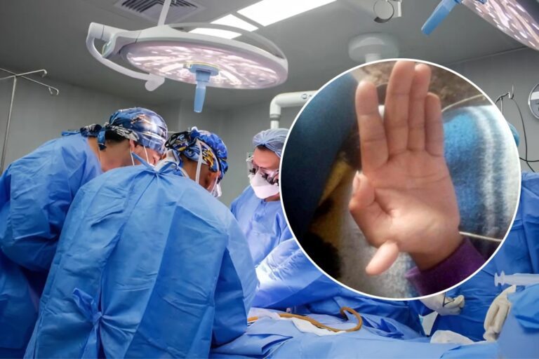 Exitosa cirugía en Hospital de Majes mejora la vida de adolescente con dedos adicionales