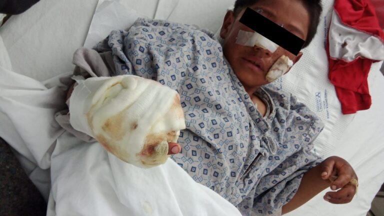 Madre clama ayuda: su niño de 8 años necesita apoyo tras perder dedos por explosión en Cusco