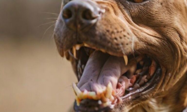 Ataque de pitbull en Matarani: mujer resulta herida al proteger a su hijo