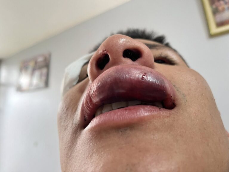 Pareja es atacada por acosadores en pleno centro de Mollendo