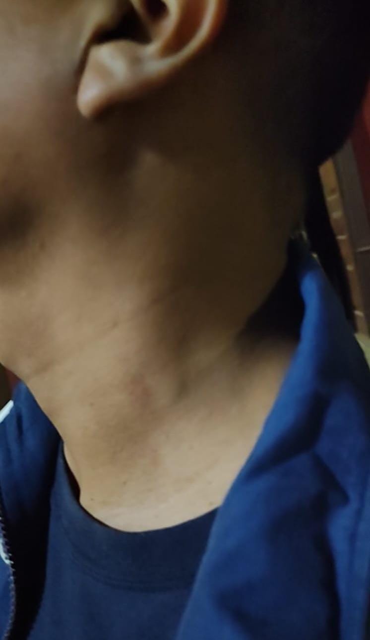 Joven casi muere electrocutado por cable expuesto 06092025 3 La Prensa Regional