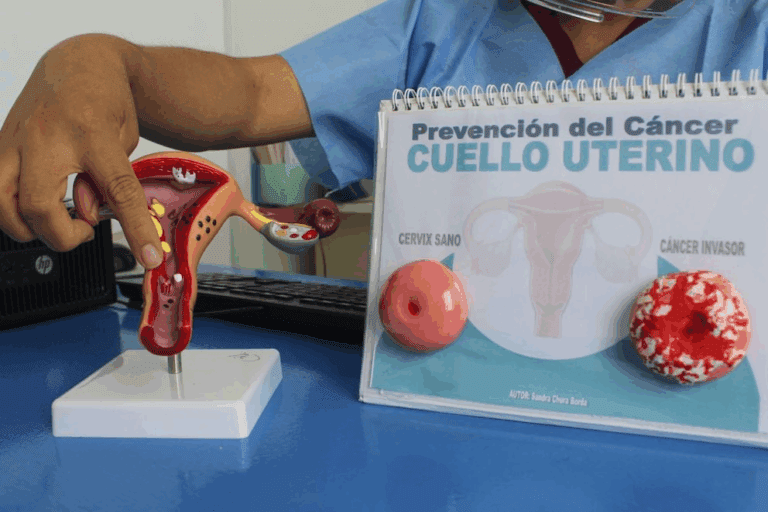 Anuncian campaña gratuita de despistaje de cáncer de mama en Mollendo