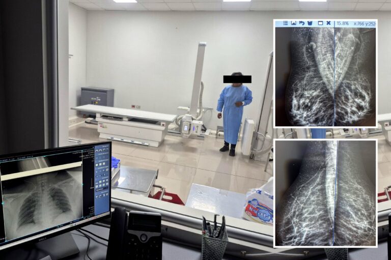 Hospital Regional de Moquegua realizó mamografías con equipo defectuoso que simulan cáncer de mama