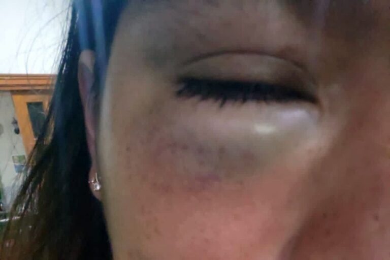 Comerciante ambulante del Mercado Central agrede a policía municipal