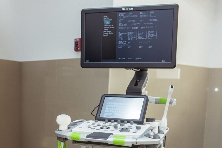 Hospital de Ilo incorpora tres nuevos ecógrafos entre otros equipos  